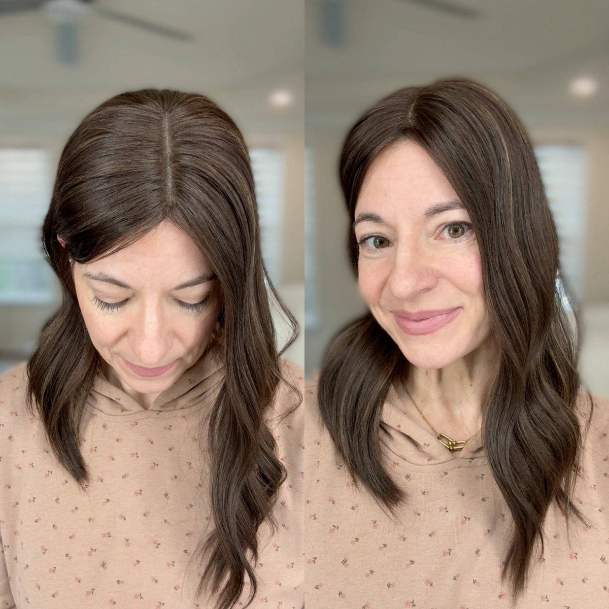 “NOLA" Premium Topper: Closed Lace Top, 7x7, 17-18"